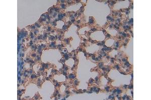 #VALUE! (BTLA antibody  (AA 30-183))