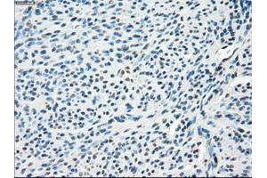 Immunohistochemical staining of paraffin-embedded endometrium tissue using anti-SLC2A5mouse monoclonal antibody. (SLC2A5 antibody)