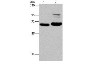 Western Blot analysis of K562 and NIH/3T3 cell using OS9 Polyclonal Antibody at dilution of 1:200 (OS9 antibody)
