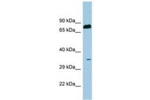 Image no. 1 for anti-serine Dehydratase (SDS) (AA 71-120) antibody (ABIN6741650) (serine Dehydratase antibody  (AA 71-120))