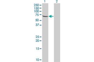 Western Blot analysis of TESK2 expression in transfected 293T cell line by TESK2 monoclonal antibody (M04), clone 5H4. (TESK2 antibody  (AA 405-542))