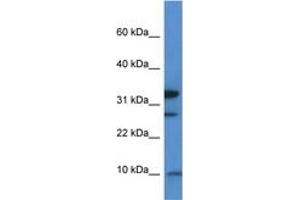 Image no. 1 for anti-Mitochondrial Ribosomal Protein S33 (MRPS33) (AA 50-99) antibody (ABIN6746526) (MRPS33 antibody  (AA 50-99))