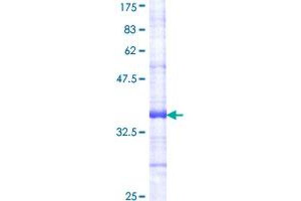 Insulin Receptor Protein (INSR) (AA 881-980) (GST tag)