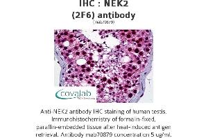 Image no. 1 for anti-NIMA (Never in Mitosis Gene A)-Related Kinase 2 (NEK2) (AA 331-445) antibody (ABIN1723728) (NEK2 antibody  (AA 331-445))