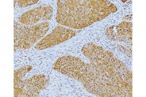 IHC analysis of YY1 using anti-YY1 antibody (ABIN7603000). (YY1 antibody  (Middle Region))