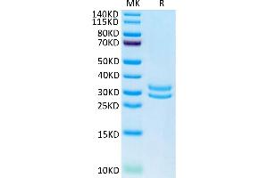 F11R Protein (AA 28-238) (His tag)