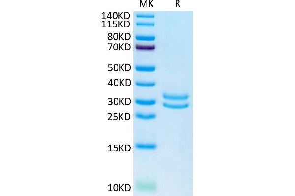 F11R Protein (AA 28-238) (His tag)