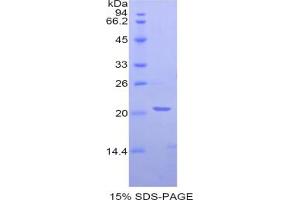 SDS-PAGE analysis of Rat NAGase Protein. (MGEA5 Protein)
