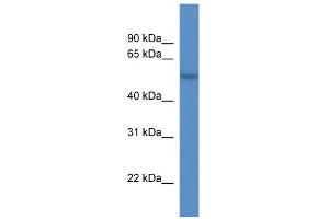 WB Suggested Anti-CDR2L Antibody Titration:  0. (CDR2L antibody  (C-Term))