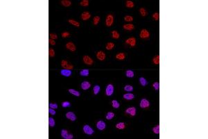 Confocal immunofluorescence analysis of U2OS cells using BC Polyclonal Antibody (ABIN6127480, ABIN6137479, ABIN6137480 and ABIN6220613) at dilution of 1:100. (BCAS2 antibody  (AA 1-225))