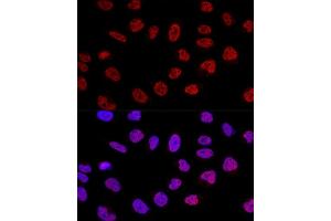 Confocal immunofluorescence analysis of U2OS cells using BC Polyclonal Antibody (ABIN6127480, ABIN6137479, ABIN6137480 and ABIN6220613) at dilution of 1:100.