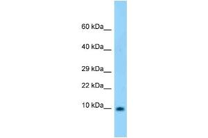 WB Suggested Anti-S100b Antibody Titration: 1. (S100B antibody  (N-Term))