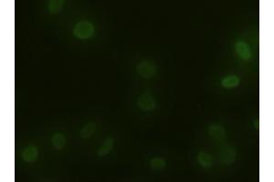 Immunofluorescent staining of HeLa cells using anti-ACTN1 mouse monoclonal antibody (ABIN2452359). (ACTN1 antibody  (AA 650-893))