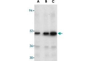 Western blot analysis of MAP3K7 in rat thymus tissue lysate with MAP3K7 polyclonal antibody  at (A) 1, (B) 2, and (C) 4 ug/mL . (MAP3K7 antibody  (N-Term))