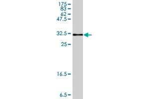 Western Blot detection against Immunogen (33. (AKR1B10 antibody  (AA 76-143))