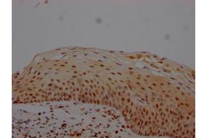 IHC image of ABIN7127619 diluted at 1:100 and staining in paraffin-embedded human tonsil tissue performed on a Leica BondTM system. (Recombinant MGMT antibody)