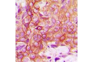 Immunohistochemistry (IHC) image for anti-Tumor Necrosis Factor Receptor Superfamily, Member 1A (TNFRSF1A) (C-Term) antibody (ABIN7297170)