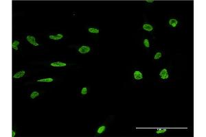 Immunofluorescence of monoclonal antibody to MARK2 on HeLa cell. (MARK2 antibody  (AA 401-500))