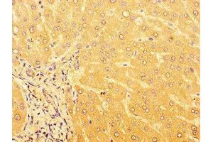 Immunohistochemistry of paraffin-embedded human liver tissue using ABIN7164477 at dilution of 1:100 (GPR179 antibody  (AA 1440-1671))