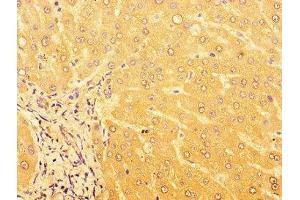 Immunohistochemistry of paraffin-embedded human liver tissue using ABIN7164477 at dilution of 1:100