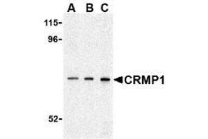 Western blot analysis of CRMP1 in 3T3 cell lysate with AP30242PU-N CRMP1 antibody at (A) 0.