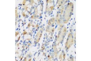 Immunohistochemistry of paraffin-embedded human gastric using RRM1 antibody at dilution of 1:200 (40x lens). (RRM1 antibody)