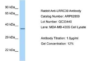 Western Blotting (WB) image for anti-Leucine Rich Repeat Containing 39 (LRRC39) (C-Term) antibody (ABIN2789270) (LRRC39 antibody  (C-Term))