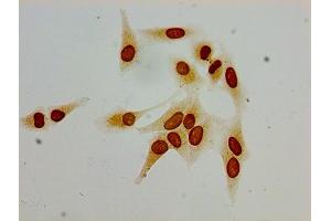 Immunocytochemistry analysis of Hela cells using ABIN7139190 at dilution of 1:100 (HIST1H1C antibody  (acLys62))