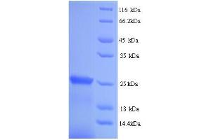 SDS-PAGE (SDS) image for Suppressor of Cytokine Signaling 1 (SOCS1) (AA 1-211), (full length) protein (His tag) (ABIN5713854)