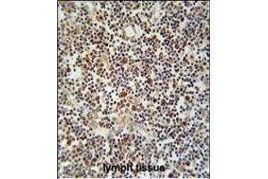 CLM1 Antibody (N-term) (ABIN653906 and ABIN2843144) immunohistochemistry analysis in formalin fixed and paraffin embedded human lymph tissue followed by peroxidase conjugation of the secondary antibody and DAB staining.