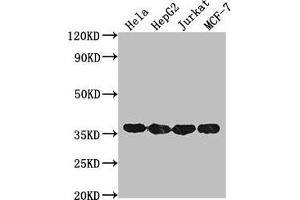 Western Blot Positive WB detected in: Hela whole cell lysate, HepG2 whole cell lysate, Jurkat whole cell lysate, MCF-7 whole cell lysate All lanes: GAPDH antibody at 1:2000 Secondary Goat polyclonal to mouse IgG at 1/50000 dilution Predicted band size: 36 KDa Observed band size: 36 KDa Exposure time: 30s (GAPDH antibody  (AA 3-335))