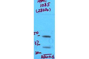 Aquaporin 1 Western Blot. (Aquaporin 1 antibody  (N-Term))