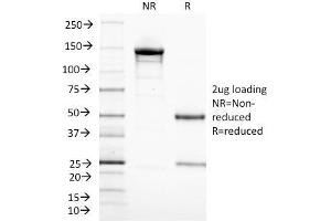 SDS-PAGE Analysis Purified CD3 epsilon Monoclonal Antibody (C3e/1308). (CD3 epsilon antibody  (AA 23-119))
