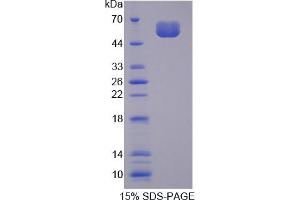 Image no. 1 for Sclerostin (SOST) (AA 25-209) protein (His tag,GST tag) (ABIN6236926) (Sclerostin Protein (SOST) (AA 25-209) (His tag,GST tag))