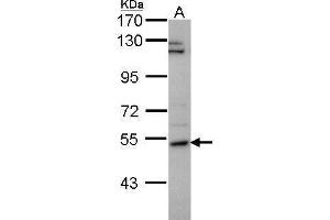 WB Image Sample (30 ug of whole cell lysate) A: H1299 7. (P4HA2 antibody)