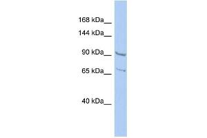 WB Suggested Anti-RALGDS Antibody Titration: 0. (RALGDS antibody  (N-Term))