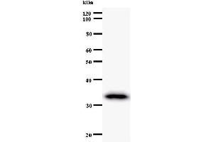 Western Blotting (WB) image for anti-TAF6 RNA Polymerase II, TATA Box Binding Protein (TBP)-Associated Factor, 80kDa (TAF6) antibody (ABIN933107) (TAF6 antibody)