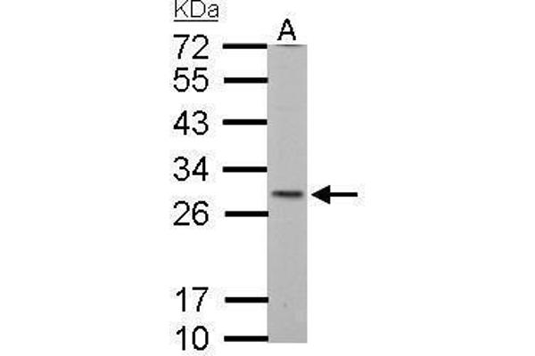 SDHB antibody  (C-Term)