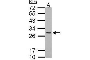 WB Image SDHB antibody [C2C3], C-term detects SDHB protein by Western blot analysis. (SDHB antibody  (C-Term))