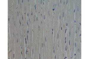 Rat heart tissue was stained by Preimmunoserum (Adiponectin Receptor 1 antibody  (AA 357-375))