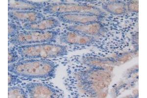 Figure. (REG3B antibody  (AA 27-175))