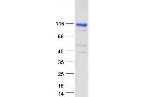 Validation with Western Blot (STRIP2 Protein (Transcript Variant 1) (Myc-DYKDDDDK Tag))