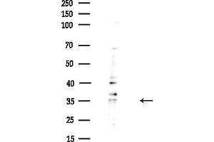 anti-Ribonuclease H1 (RNASEH1) (Internal Region) antibody