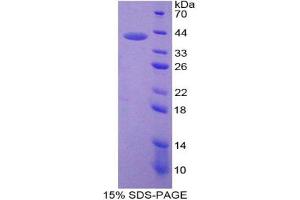 SDS-PAGE analysis of Mouse Neuromedin B Protein. (Neuromedin B Protein)
