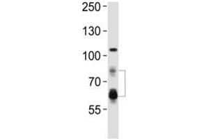 Western Blotting (WB) image for anti-Proprotein Convertase Subtilisin/kexin Type 9 (PCSK9) (AA 144-173) antibody (ABIN3032339)