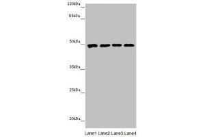 Western blot All lanes: CYP3A43 antibody at 2. (CYP3A4 antibody  (AA 244-503))