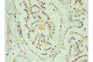 Immunohistochemistry of paraffin-embedded human prostate tissue using ABIN7170965 at dilution of 1:100 (SULT2B1 antibody  (AA 1-365))