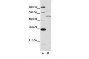 Image no. 1 for anti-Zinc Finger Protein 707 (ZNF707) (AA 26-75) antibody (ABIN6736219) (ZNF707 antibody  (AA 26-75))