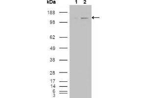 Western Blot showing ABL2 antibody used against HEK293T cells transfected with the pCMV6-ENTRY control (1) and pCMV6-ENTRY ABL2 cDNA (2). (ABL2 antibody)