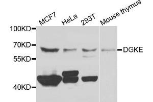 Western blot analysis of extracts of various cells, using DGKE antibody. (DGKE antibody)